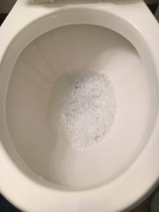 toilet bowl stains 1